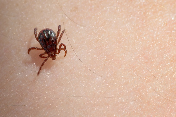 Brown dog tick on skin