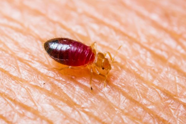 Bed bug bites