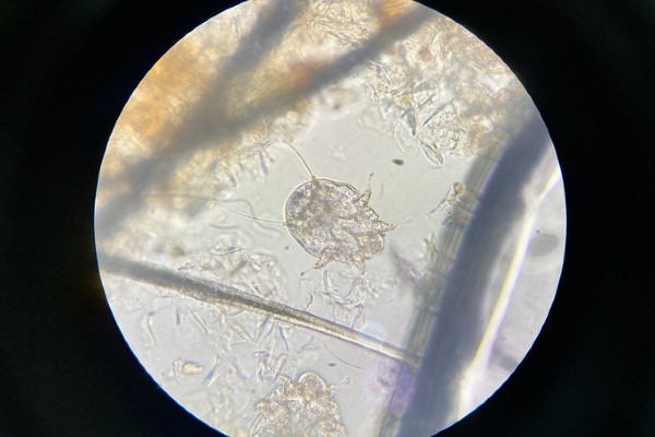 scabies mites under microscope