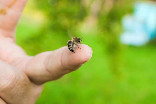 Bee sting human hand